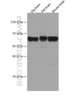 ACVR1 Monoclonal antibody proteintech 67417-1-Ig