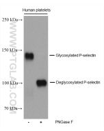 P-selectin / CD62P Monoclonal antibody proteintech 60322-1-Ig