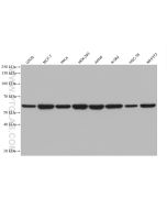 HDAC2 Monoclonal antibody proteintech 67165-1-Ig