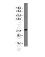 Transgelin 2 Monoclonal antibody proteintech 60044-1-Ig
