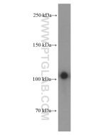 EPHA1-specific Monoclonal antibody proteintech 60155-2-Ig