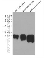 FABP2 Monoclonal antibody proteintech 67691-1-Ig