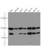ACTN4 Monoclonal antibody proteintech 66628-1-Ig