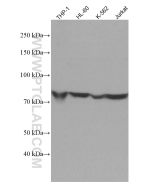 ADRBK1 Monoclonal antibody proteintech 67067-1-Ig