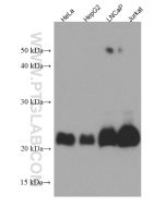 MGMT Monoclonal antibody proteintech 67476-1-Ig
