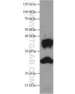 AQP1 Monoclonal antibody proteintech 66805-1-Ig