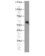 Fetuin-A/AHSG Monoclonal antibody proteintech 66094-1-Ig