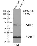 P4HA2 Monoclonal antibody proteintech 66604-1-Ig
