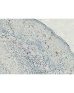 CD207 Monoclonal antibody proteintech 67788-1-Ig