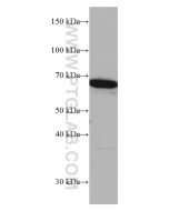 TERF2 Monoclonal antibody proteintech 66893-1-Ig