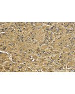 POMC Monoclonal antibody proteintech 66358-1-Ig