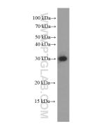 CLPP Monoclonal antibody proteintech 66271-1-Ig