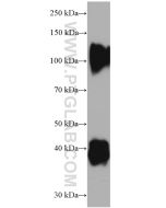 Decorin Monoclonal antibody proteintech 66847-1-Ig