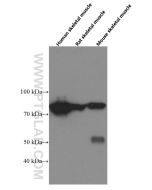 PADI2 Monoclonal antibody proteintech 66386-1-Ig