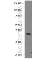 AKR7A2 Monoclonal antibody proteintech 66677-1-Ig
