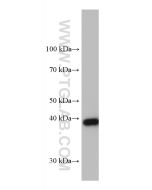 GSNOR,ADH5 Monoclonal antibody proteintech 66193-1-Ig
