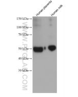 Alpha-1-Antitrypsin Monoclonal antibody proteintech 66135-1-Ig
