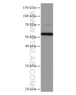 CYP27A1 Monoclonal antibody proteintech 67045-1-Ig