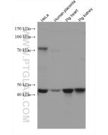 UQCRC2 Monoclonal antibody proteintech 67547-1-Ig