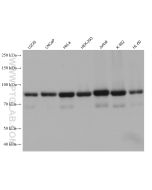 ESYT2 Monoclonal antibody proteintech 68374-1-Ig