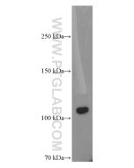 C5 Monoclonal antibody proteintech 66634-1-Ig