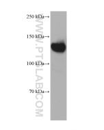 ULK1 Monoclonal antibody proteintech 68445-1-Ig