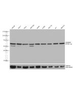 HNRNPK Monoclonal antibody proteintech 67708-1-Ig