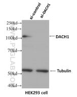 DACH1 Monoclonal antibody proteintech 60082-1-Ig