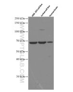 MLPH Monoclonal antibody proteintech 66092-1-Ig