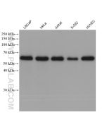 FTO Monoclonal antibody proteintech 68111-1-Ig