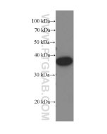 Amphiregulin Monoclonal antibody proteintech 66433-1-Ig