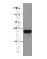 SERPINB9 Monoclonal antibody proteintech 67950-1-Ig