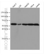 DLD Monoclonal antibody proteintech 67702-1-Ig