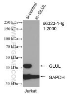 Glutamine Synthetase Monoclonal antibody proteintech 66323-1-Ig