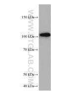 HK3 Monoclonal antibody proteintech 67803-1-Ig