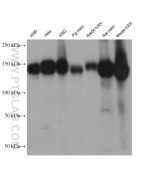 Integrin alpha-5/CD49e Monoclonal antibody proteintech 68561-1-Ig