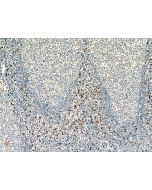 Granzyme K Monoclonal antibody proteintech 67272-1-Ig