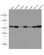 PHGDH Monoclonal antibody proteintech 67591-1-Ig