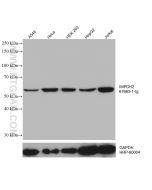 IMPDH2 Monoclonal antibody proteintech 67663-1-Ig