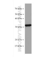 KLRB1/CD161 Monoclonal antibody proteintech 67537-1-Ig