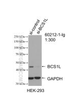 BCS1L Monoclonal antibody proteintech 60212-1-Ig
