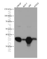 LGMN Monoclonal antibody proteintech 67017-1-Ig