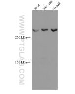 ATM Monoclonal antibody proteintech 67586-1-Ig