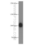 Plasminogen Monoclonal antibody proteintech 66399-1-Ig
