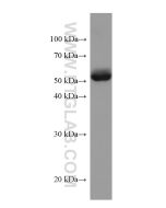 ANGPTL4 Monoclonal antibody proteintech 67577-1-Ig