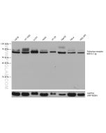 CD155/PVR Monoclonal antibody proteintech 66913-1-Ig