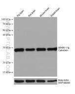 Calretinin Monoclonal antibody proteintech 66496-1-Ig