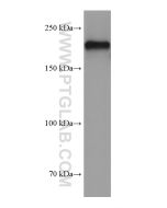 NF-H/NF200 Monoclonal antibody proteintech 60331-1-Ig