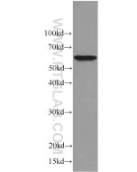 C9orf72 Monoclonal antibody proteintech 66140-1-Ig