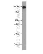 LGALS3BP Monoclonal antibody proteintech 60066-1-Ig